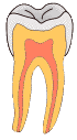Pit-and-Fissure-Caries-GIF