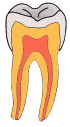 smooth_surface_caries_gif